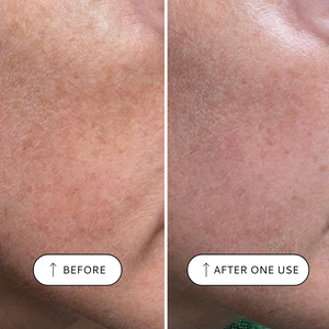 Sensitive Resurfacing Peel, 10% Lactic Acid and Super Seeds - 30ml