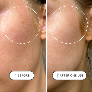 Sensitive Resurfacing Peel, 10% Lactic Acid and Super Seeds - 30ml