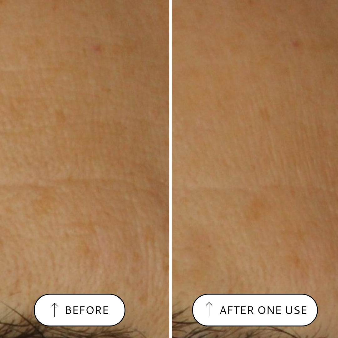 Super Renewal Serum, Retinol Alternative - 30ml